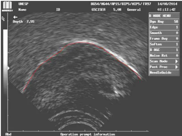 Figura 7: Imagem capturada de ultrassom corresponde à fase 5 da  visualização ultrassonográfica da deglutição orofaríngea em corte sagital