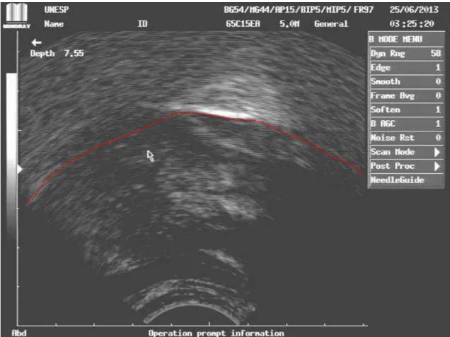 Figura 8b: Imagem capturada de ultrassom ilustrando a utilização da porção  média da língua contra o palato para conter o bolo alimentar na cavidade oral