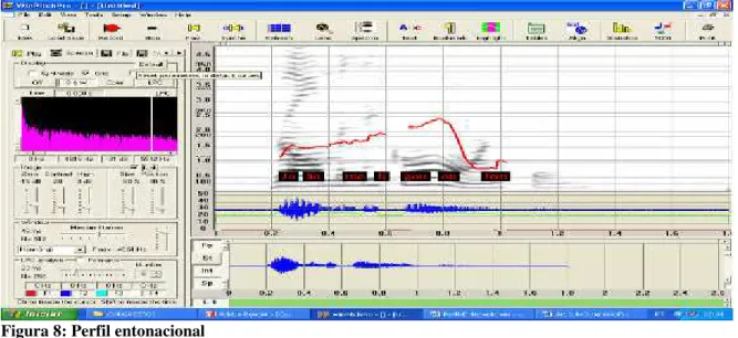 Figura 8: Perfil entonacional 