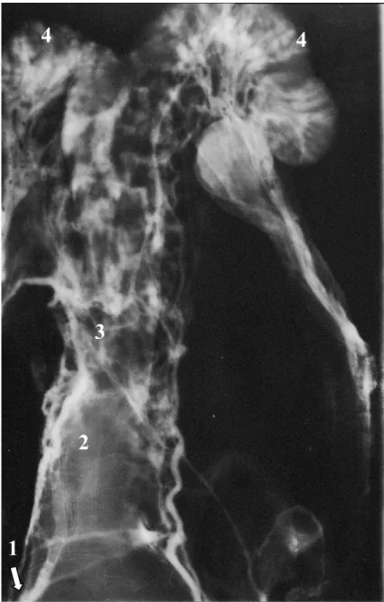 Figura 1. Lâmina radiográfica de órgão genital de fêmea bovina (vista ventral), coletado em matadouro
