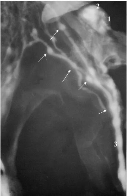 Figura 2. Lâmina radiográfica do órgão genital (vista ventral), infundido com contraste radiográfico em  um único ramo da veia vaginal, no sentido cranial ao órgão