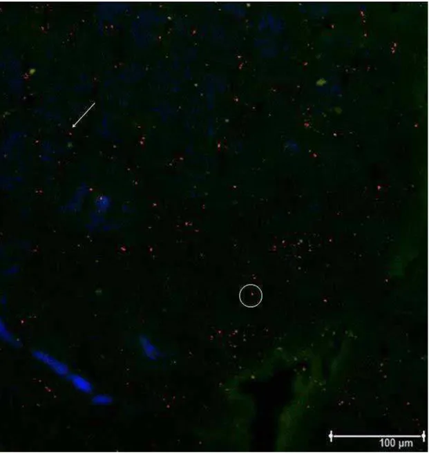 Figura 2 - Imagem de imunofluorescência pela microscopia confocal (100x) do corte  do tecido muscular do músculo brachiocephalicus de um equino biopsiado na região do  transplante de CTM-MO marcadas com o nanocristal Qtracker® 655 após 24 horas o  transpla