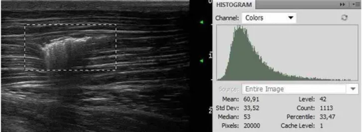 Figura 9 - Análise da imagem ultrassonográfica realizada no músculo brachiocephalicus de  um equino após transplante de CTM-MO não marcadas com o nanocristal Qtracker® 655 pela  técnica do histograma no software Photoshop CS4®