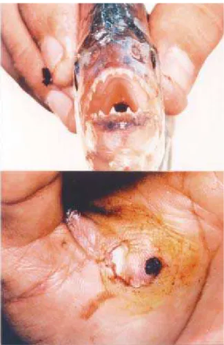 Figura 6 - Detalhe dos dentes de uma piranha (Serrassalmidae) e acidente na mão de um pescador.