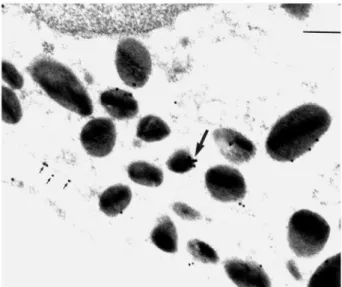 FIG. 2. Electron micrographs showing ANXA1  immunogold in extravascular eosinophils as detected by LCPS1 and LCS3 antisera