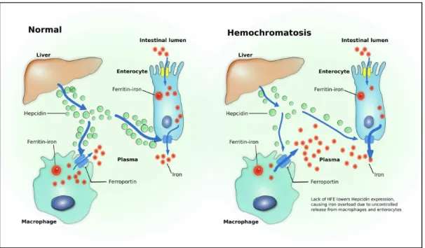 Figure 1.1: Iron metabolism in healthy patients and in hemochromatosis. Adapted from P