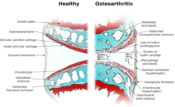 Figure 1.2: Structural changes and selected signalling and eﬀector molecules in the development of osteoarthritis