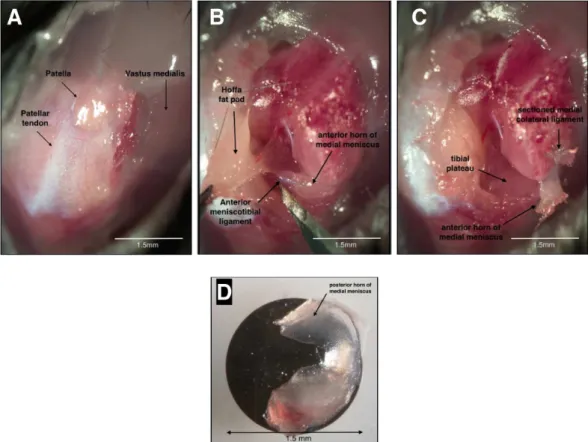 Figure 3.2: Surgical induction of osteoarthritis in the mouse knee. A) Knee joint after exposure of subcutaneous tissue and medial arthrotomy