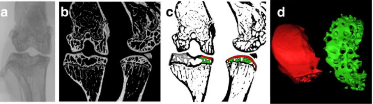 Figure 3.3: Process of micro-CT acquisition and analysis. The digitized image a) is reconstructed and resliced in orthogonal sagittal and coronal projections b), using a predefined threshold, the grayscale images are binarized and the ROIs are selected c),