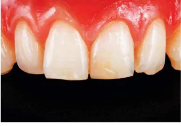Fig. 1: Initial photo