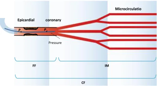 Figure 2  –  Schematic of physiological assessment (FFR, CFR and IMR) using a coronary pressure  and temperature wire 