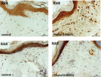 Figure 6: Effects of phytol on RXR and RAR synthesis (brown pre- pre-cipitate) in human skin fragments labelled with RXR and  anti-RAR antibodies after a 48-hour incubation (40x magnification).