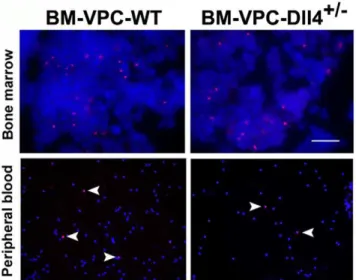 Figure 4. Dll4+/-BM-VPC increase tumour vessel density in tumors. Endothelial cells were identified by immunofluorescence using anti-CD31 (PE-CAM) in tumor cryosections from mice inoculated with BM-VPC-WT or BM-VPC-Dll4