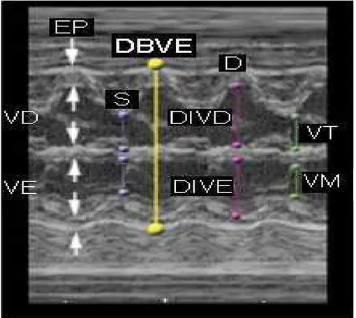FIGURA 3 - Imagem ultra-sonográfica em modo-M e medida do DBVE. 