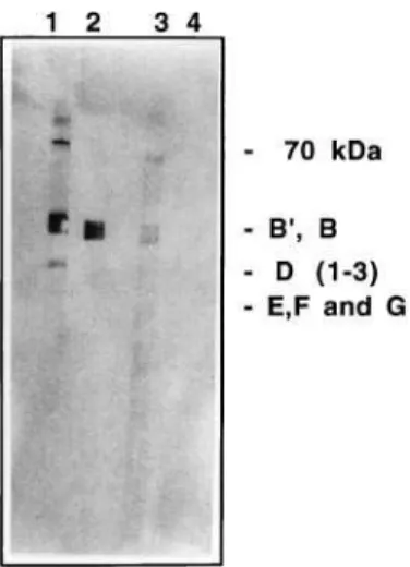 Fig. 3. Immunoprecipitation of human UsnRNPs with antisera to the yeast peptide containing the Sm motif 1
