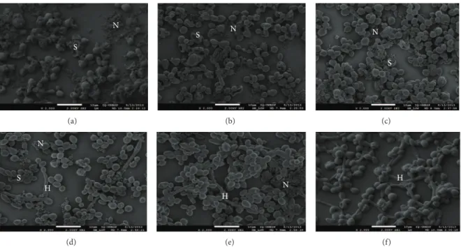 Figure 10: FEG-SEM of C. albicans biofilms with different concentrations of the HA@Ag solution: (a) 1000, (b) 500, (c) 250, (d) 125, (e) 62.5, and (f, control) 0 
