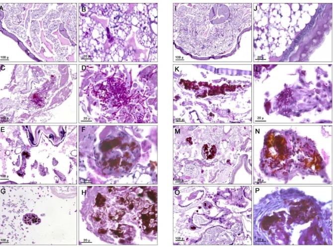 Figure 9. Effect of antifungal treatment of haemocyte density and melanization of G. mellonella infected with C