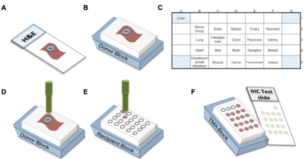 Figure 4 – Steps for tissue microarray construction. Selection of interesting structures on A