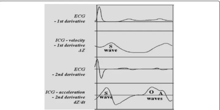 Fig. 1 ICG waves in diastolic dysfunction (adapted from Bour et al. [5])