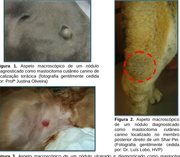 Figura  1.  Aspeto  macroscópico  de  um  nódulo  diagnosticado como mastocitoma cutâneo canino de  localização  torácica  (fotografia  gentilmente  cedida  por: Profª Justina Oliveira) 