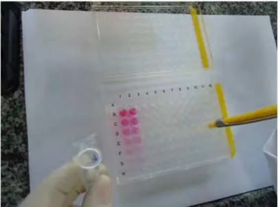 FIGURA  4  –  Microplaca  sendo  preparada  para  leitura  -  determinação  da  concentração de malondialdeído