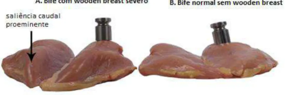Figura 18- Comparação entre um bife com wooden breast e sem wooden breast (Kuttappan et al.,  2017)  A  miopatia  WB  pode  apresentar  lesões  histológicas  sobrepostas,  principalmente: 
