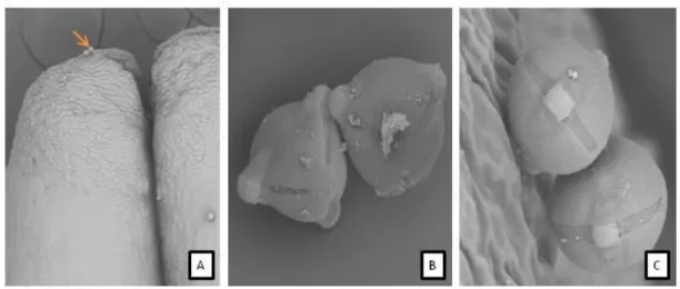 Figura  8.  Antera  e  grãos  de  pólen  de  Solanum  melongena.  (A)  detalhe  do  poro  da  antera (180x)  –  seta indicando a presença de grãos de pólen próximos à abertura;  (B)  grão de pólen de antera brevistila (3.0kx); (C) grão de pólen de antera l