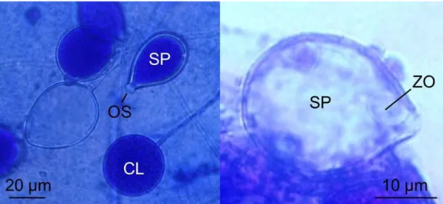 Figura 1. Estruturas reprodutivas de  Phytophthora  nicotianae vistas sob microscopia  óptica