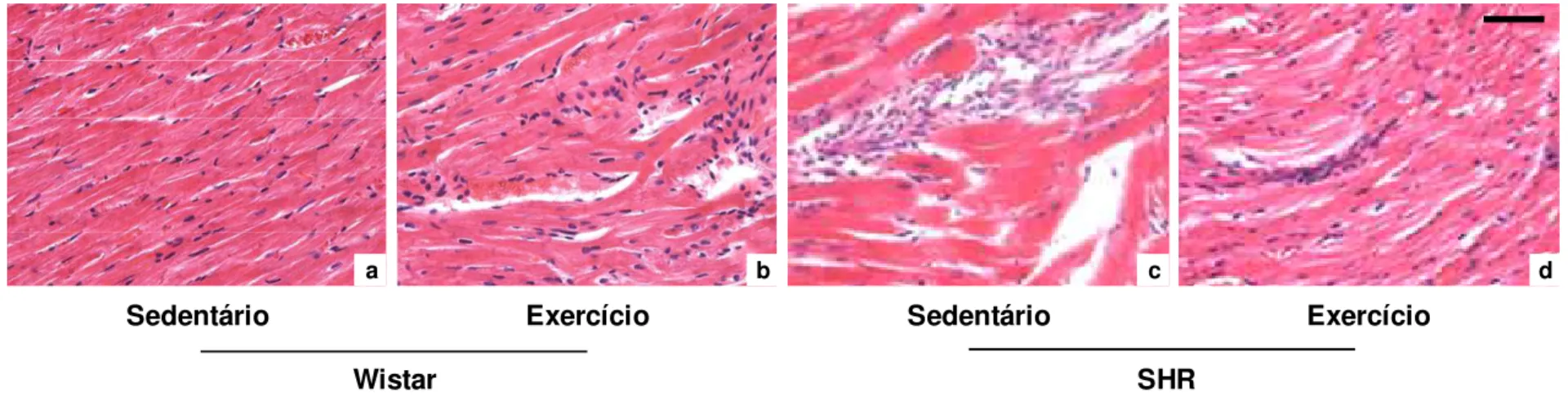 Figura 4: Fotomicrografias de cortes histológicos do ventrículo esquerdo de ratos normotensos e hipertensos