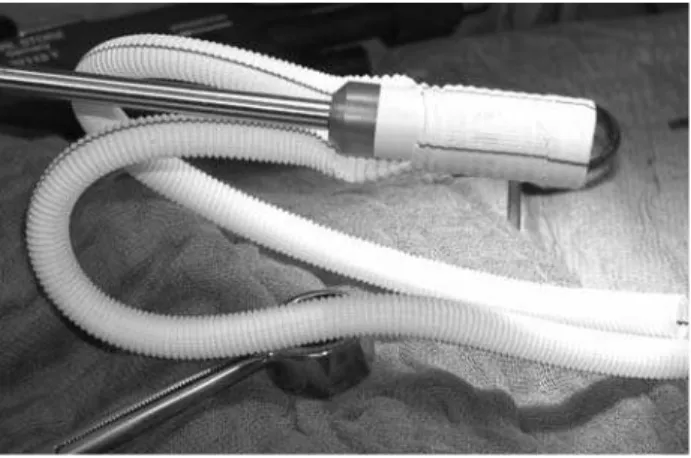 Table 1 - Perioperative and operative parameters of hybrid pro- pro-cedures