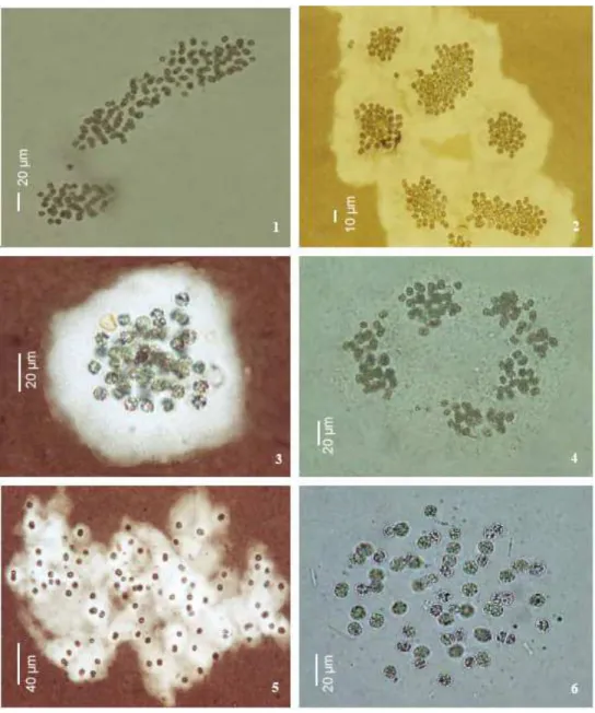 Figura 3.2 – Cianobactérias do gênero Microcystis. Painéis 1-4: Microcystis aeruginosa;  painéis 5-6: Microcystis protocystis
