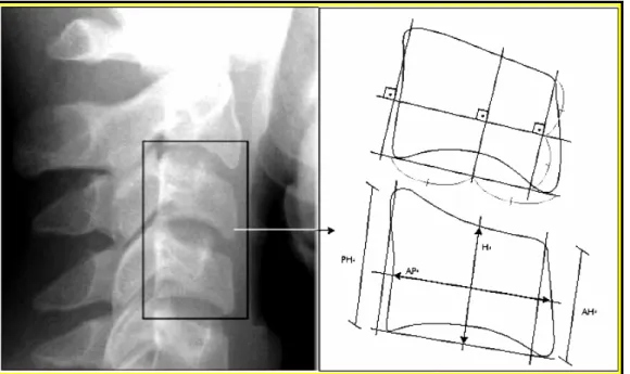 FIGURA 1: Corpo das vértebras cervicais C3 e C4 mensurados por meio de  radiografia cefalométrica lateral: (AH) altura anterior do corpo  vertebral, (AP) largura antero-posterior do corpo vertebral e (H)  altura do corpo vertebral, (PH) altura posterior do