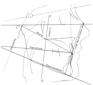 Figura 15 – Linhas e planos para localização do ponto J e construção do diagrama de  Andrade