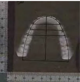 Figura 17 - Diagrama sobreposto à imagem digitalizada do modelo, em que se verifica  coincidência, apresentando forma ideal o arco dentário