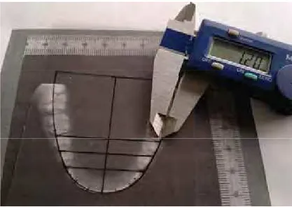 Figura 21 - Mensuração da diferença entre o diagrama de Andrade e a imagem  digitalizada do modelo de gesso, na região de molares inferiores