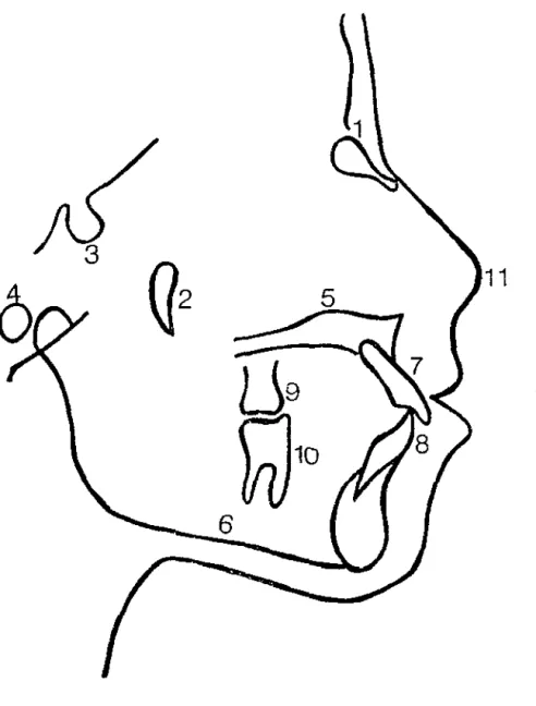 FIGURA  1- Celafograma com as estruwras anatômicas 
