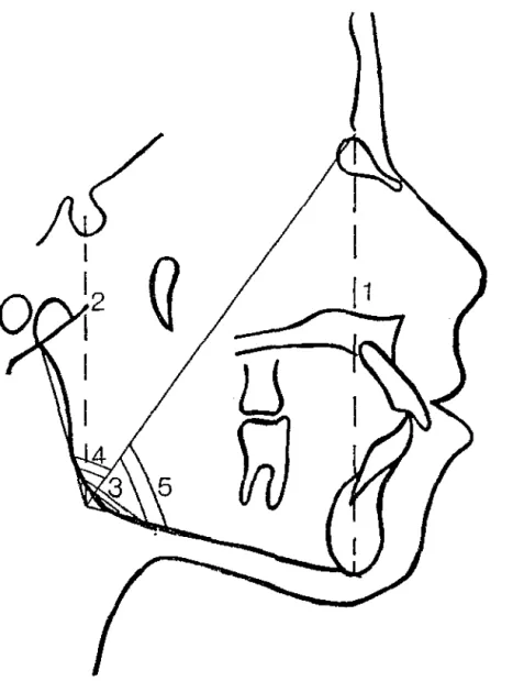 FIGURA  3- Cefalograma com grandezas cefalométricas lineares e angulares  l.  Altura total anterior  da  face  4