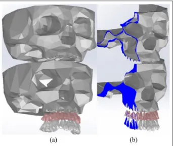Figure 1. Exploded perspective of the components of the skull/maxilla, and their representation in the form of the complete structures (a) and their cross-sectional view (b).