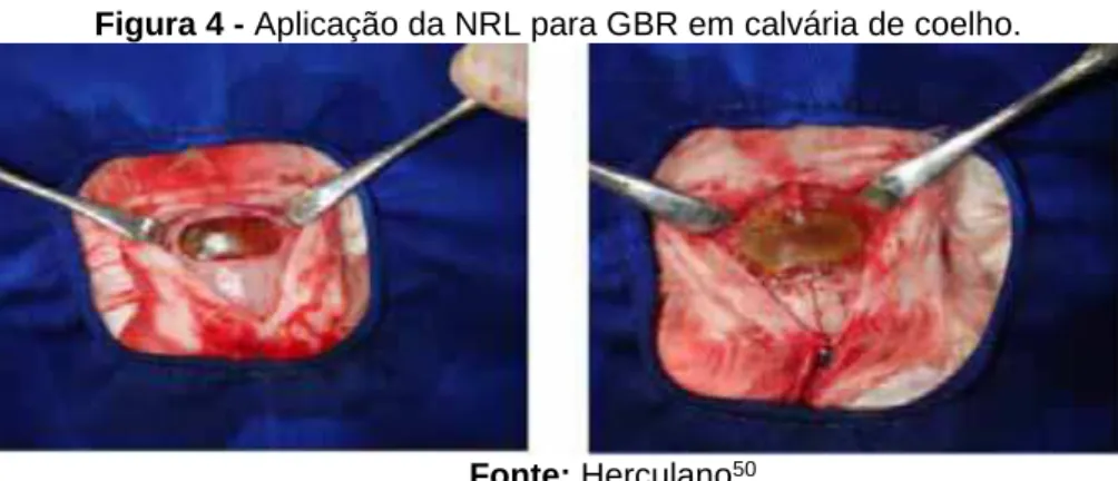Figura 4 - Aplicação da NRL para GBR em calvária de coelho. 
