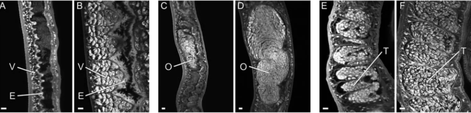Figure 2. Most surviving worms are morphologically degenerate. Confocal microscopy on selected tissues of adult worms recovered from the portal system of rhesus macaques (A, C, E) and mice (B, D, F), and stained with Langeron’s carmine