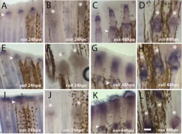 Fig. 4. Expression of skeletogenesis genes after crush injury. (A–L) Whole mount in situ hybridization for mRNA detection of (A–D) osterix at (A) 24 hpa; (B) 24 hpc (C) 48 hpa (D) 48 hpc; (E–H) collagen I at (E) 24 hpa (F) 24 dpc (G) 48 hpa (H) 48 hpc; (I–