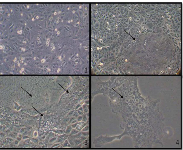 Fig.  1 .  VDST  under  RT-qPCR  positive  urine  inoculation.  1.  Negative  control