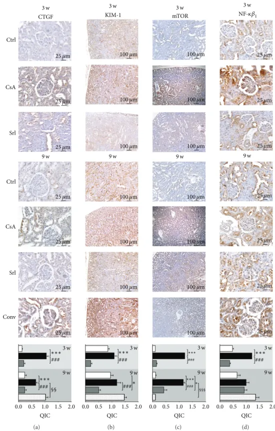 Figure 7: Kidney protein expression by immunohistochemistry. CTGF (a), KIM-1 (b), mTOR (c), and NF-
