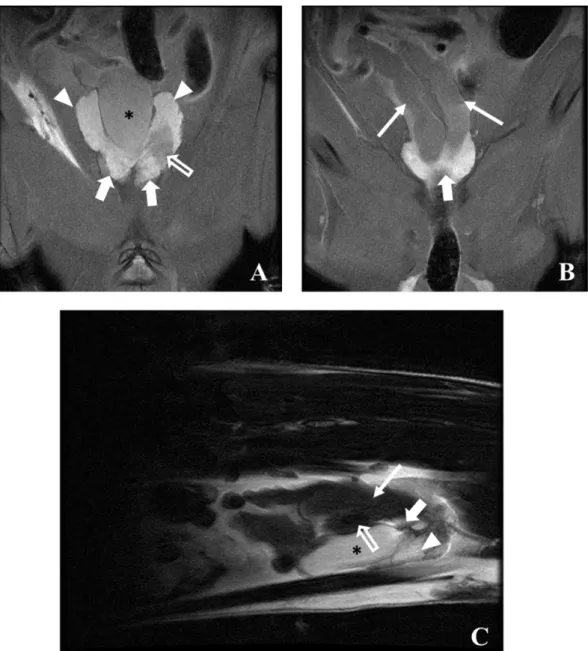 Figure 9. MRI PD weighted images of a cancer-induced animal, 58 weeks of age in dorsal (A,B) and  sagittal (C) plane