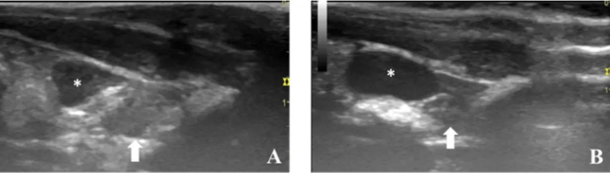 Figure 5. Longitudinal ultrasonographic scan of prostate from control animals (A,B). The dorsal  prostate lobe (arrow) is observed dorsally to the neck of the urinary bladder (asterisk)