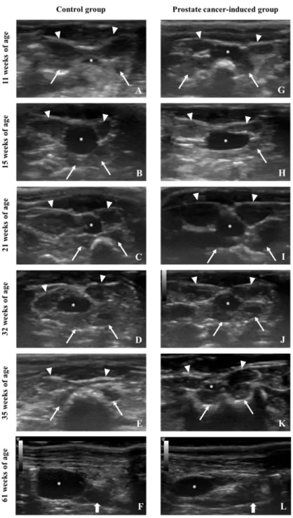 Figure 6. Prostates of both control (A–F) and prostate cancer-induced (G–L) animals were monitored by ultrasonography through the experimental protocol at the same time points