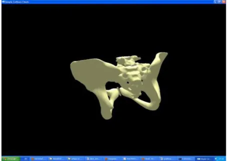 FIGURA 4.8 - Aplicação de visualização em 3D do CyberMed executada no SO Windows  (adotado de MORAIS et al., 2011)