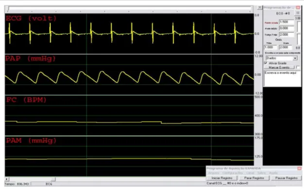 Figura  9-  Representação  da  janela  de  visualização  do  software  Kananda®  durante  o  registro  eletrocardiográfico  e  de  pressão  arterial