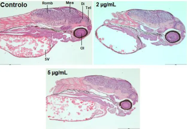 Figura 17: Imagens ilustrativas de cortes histológicos de larvas de peixe-zebra (Danio rerio),  expostos  a  0,  2  e  5  µg/mL  de  glifosato(HBG)
