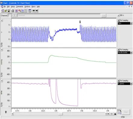 Figura  5 –  Representação  da  janela  de  visualização  do  software  Chart®  durante  um  experimento  de  medida  indireta  da  pressão  arterial  sistólica